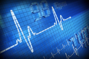Smart CPAP