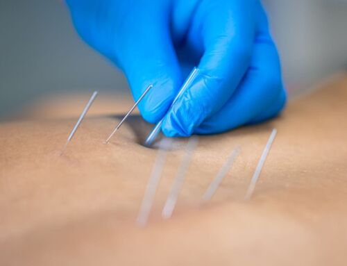 Agopuntura e insonnia: un approccio integrato per dormire meglio